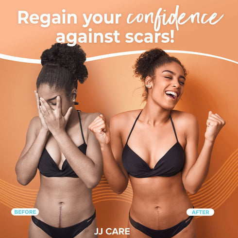 JJ CARE Soft Silicone Tape, 1.6” x 60” Flexible Silicone Scar Tape, Medical Grade Silicone Strips for Scars, Washable & Reusable Scar Tape for Surgical Scars, Latex-Free Scar Tape
